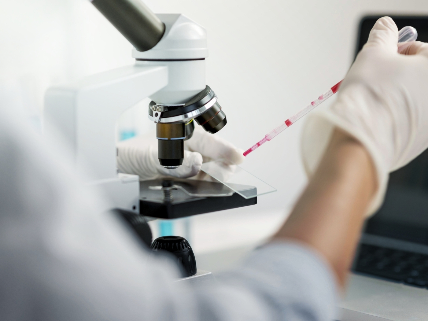Assistenza legale Mesotelioma: nuove evidenze dal confronto tra BAP1 e tumore renale
